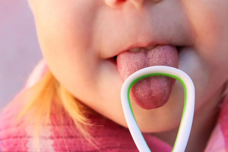 Como limpar a língua: uso de raspadores de língua em bebê